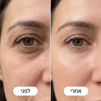 ערכת PDRN הקוריאנית | SkinFlash™