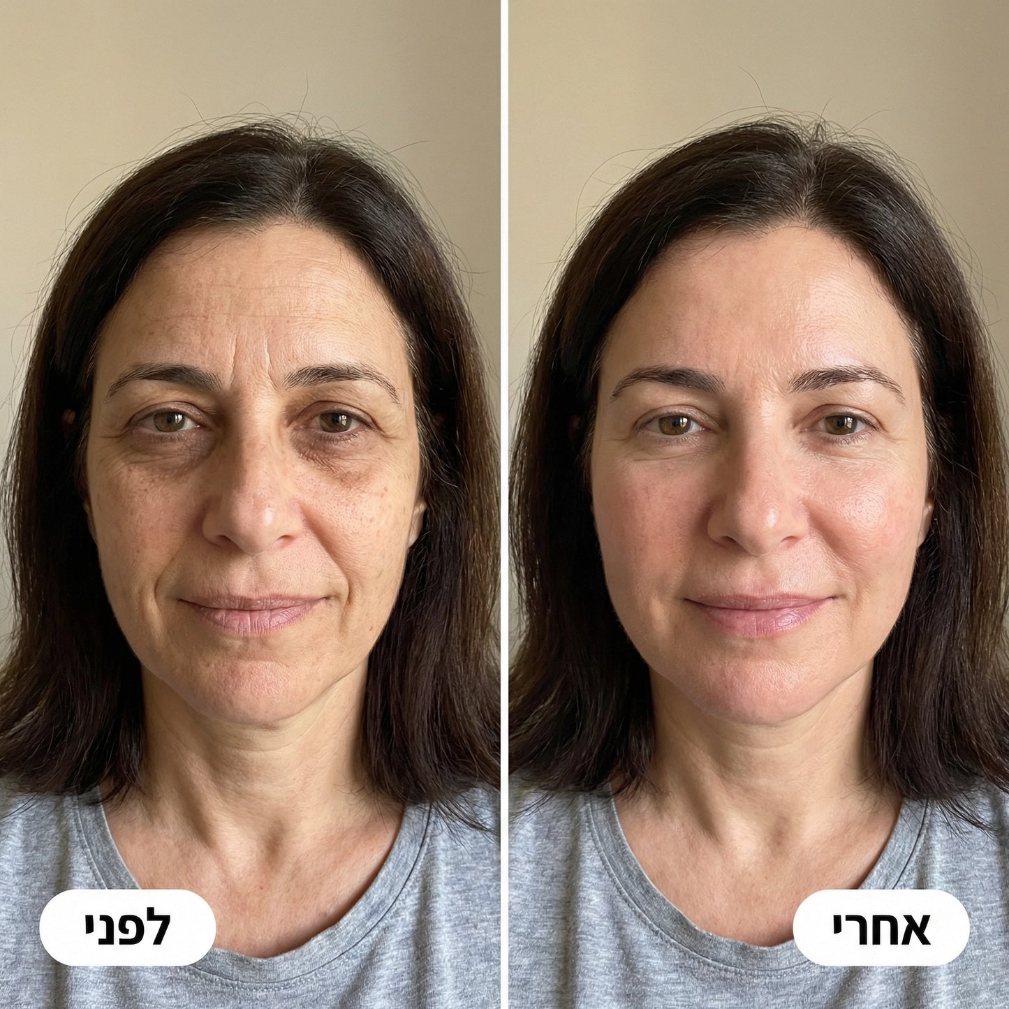 SkinFlash | ערכת PDRN וקולגן ורוד של Medicube